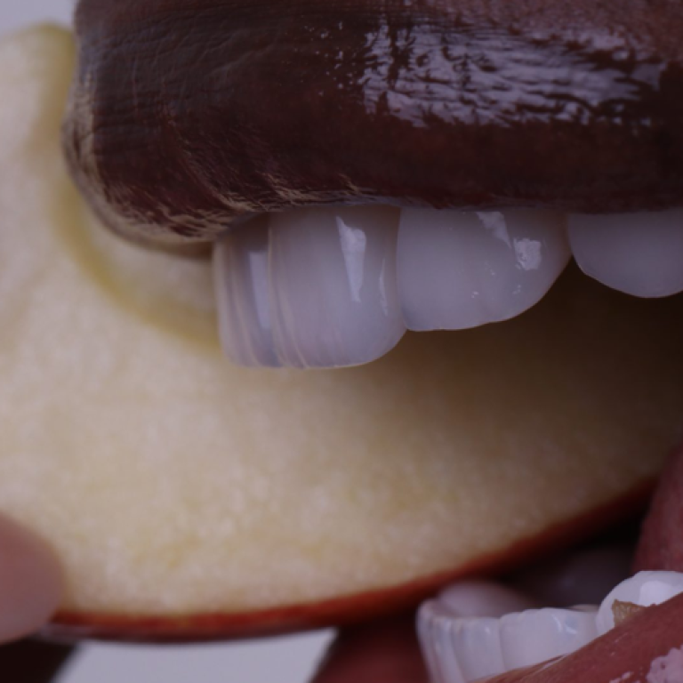 root-canal-treatment-clinic